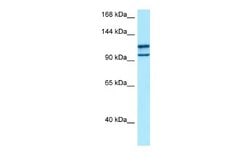 myosin X Rabbit anti-Human, Polyclonal, Novus Biologicals 0.1 mL | Buy Online | Novus Biologicals | Fisher Scientific